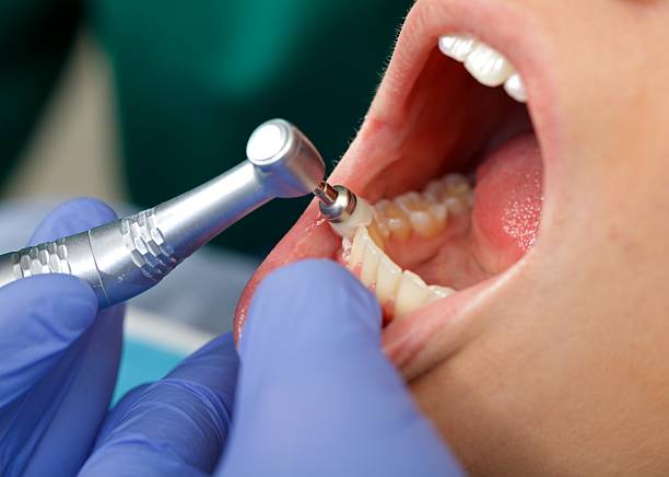 Professional Dental Services in University Heights, OH